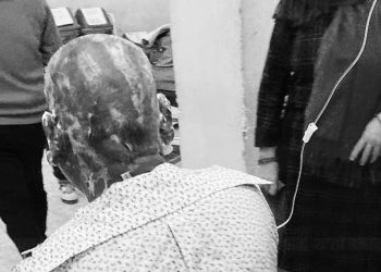 बागलुङमा एक पुरुषले पेट्रोल छर्केर आत्मदाहको प्रयास