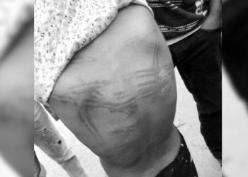 बालिकालाई कुट्ने सहायक प्राचार्य पक्राउ