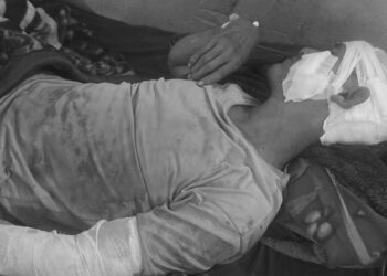 अछाममा बाघको आक्रमणबाट एक गम्भीर घाइते, स्थानीय त्रसित